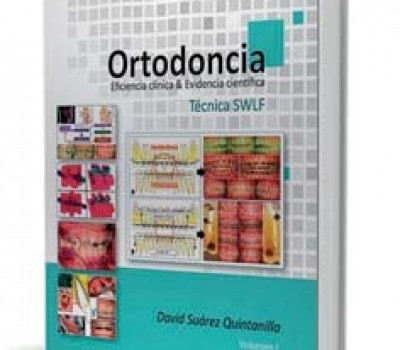 Ortodoncia – Eficiencia Clínica & Evidencia Científica – Técnica SWLF